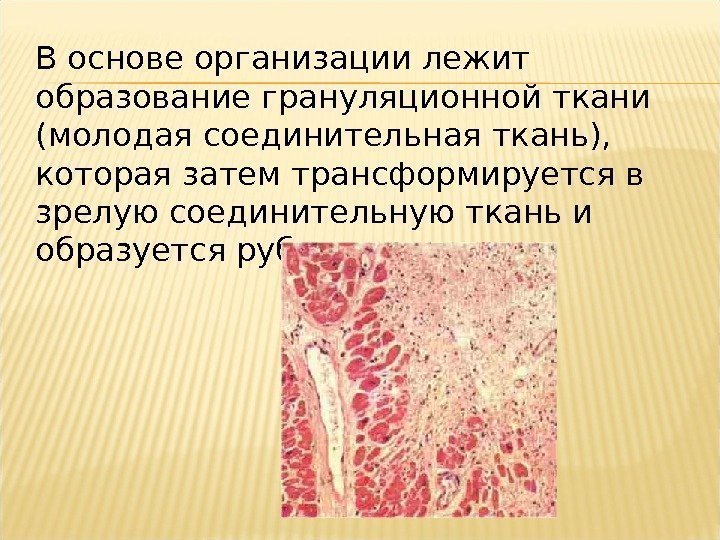 В основе организации лежит образование грануляционной ткани (молодая соединительная ткань),  которая затем трансформируется