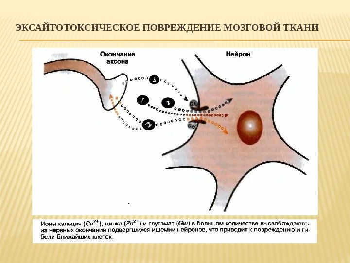 ЭКСАЙТОТОКСИЧЕСКОЕ ПОВРЕЖДЕНИЕ МОЗГОВОЙ ТКАНИ 