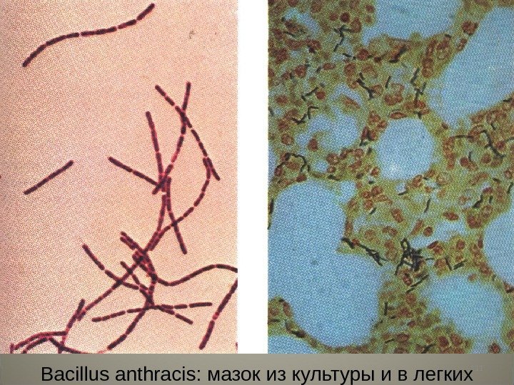 111 Bacillus anthracis:  мазок из культуры и в легких 