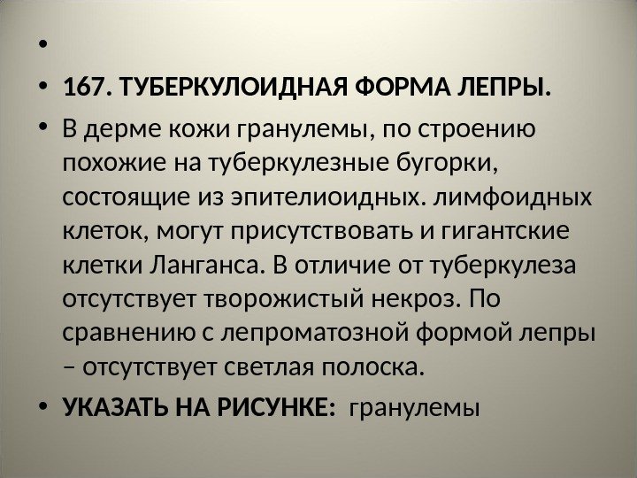  •  • 167. ТУБЕРКУЛОИДНАЯ ФОРМА ЛЕПРЫ.  • В дерме кожи гранулемы,