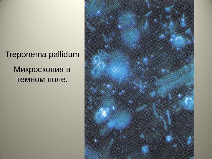 5 Treponema pallidum Микроскопия в темном поле. 