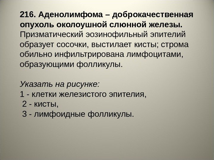 216. Аденолимфома – доброкачественная опухоль околоушной слюнной железы.  Призматический эозинофильный эпителий образует сосочки,