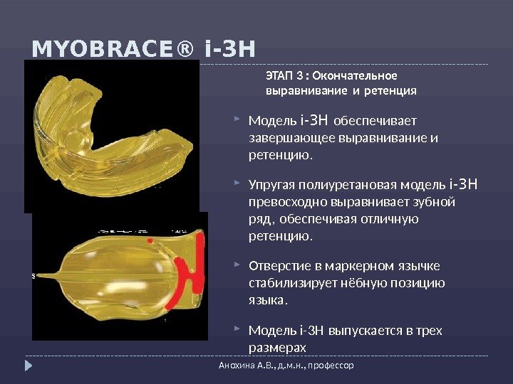 MYOBRACE® i-3 H Анохина А. В. , д. м. н. , профессор Модель i-3