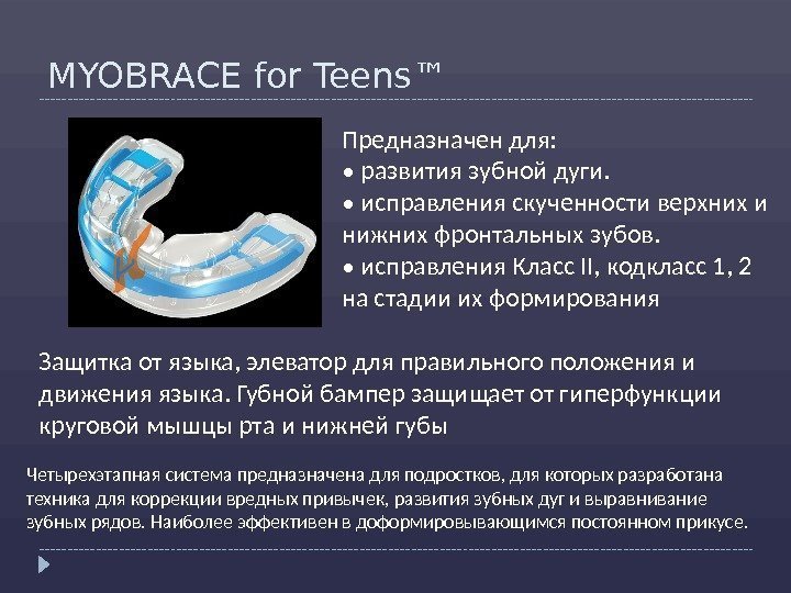 MYOBRACE for Teens™ Защитка от языка, элеватор для правильного положения и движения языка. Губной