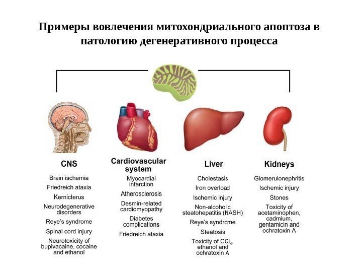 Примеры вовлечения митохондриального апоптоза в патологию дегенеративного процесса 