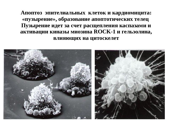 Апоптоз эпителиальных клеток и кардиомицита:  «пузырение» , образование апоптотических телец Пузырение идет за