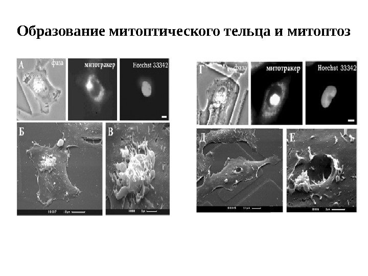 Образование митоптического тельца и митоптоз.  