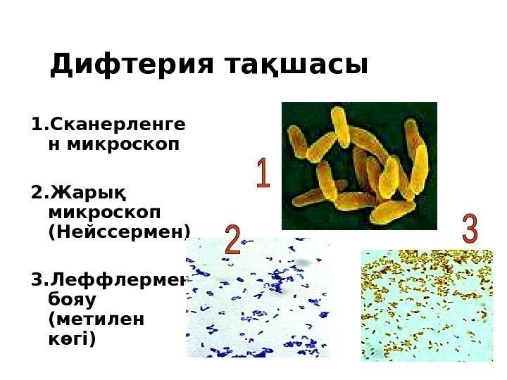 Дифтерия тақшасы 1. Сканерленге н микроскоп 2. Жарық микроскоп (Нейссермен) 3. Леффлермен бояу (метилен