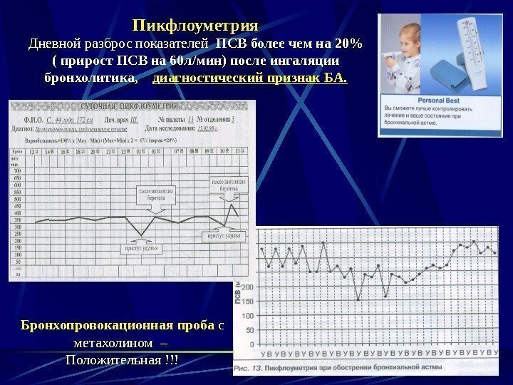 Пикфлоуметрия Дневной разброс показателей  ПСВ более чем на 20 ( прирост ПСВ на