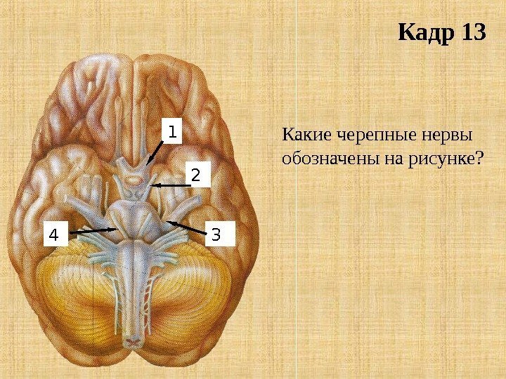 Кадр 13 1 2 34 Какие черепные нервы обозначены на рисунке? 