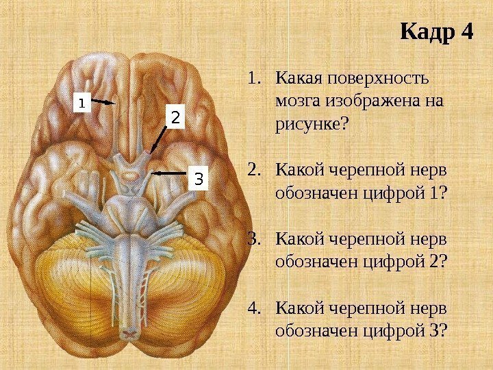 Кадр 4 1. Какая поверхность мозга изображена на рисунке? 2. Какой черепной нерв обозначен