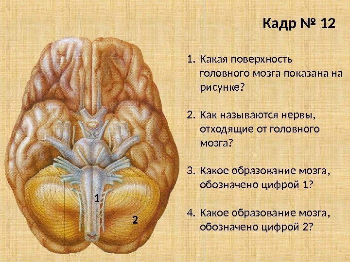 Кадр № 12 1. Какая поверхность головного мозга показана на рисунке? 2. Как называются