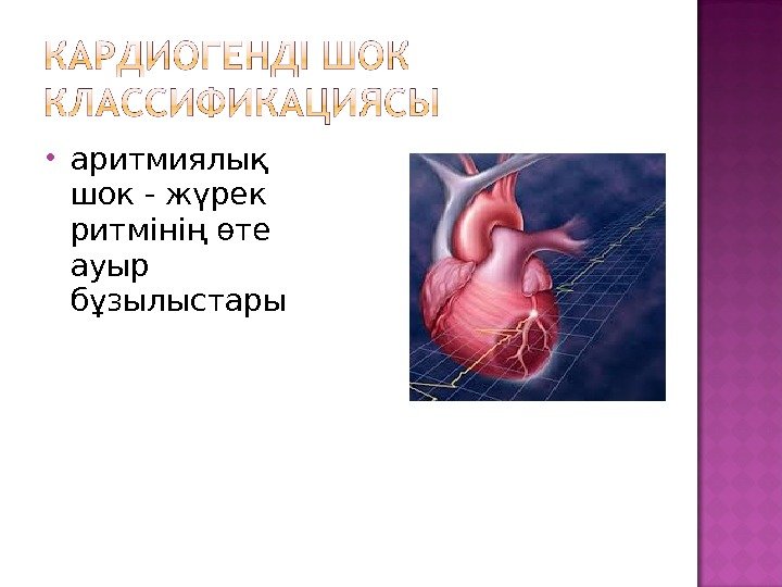  аритмиялық шок - жүрек ритмінің өте ауыр бұзылыстары 