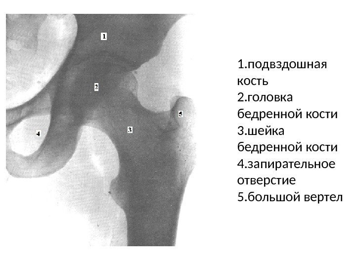 Подвздошная кость где находится фото