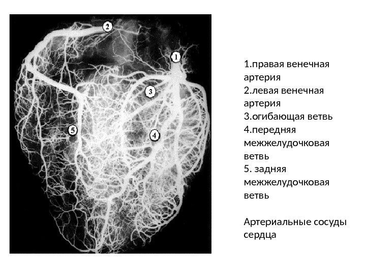 1. правая венечная артерия 2. левая венечная артерия 3. огибающая ветвь 4. передняя межжелудочковая