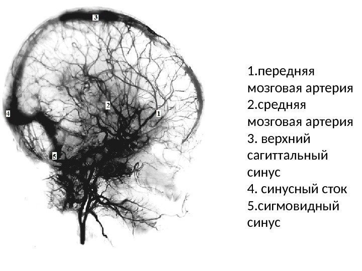 1. передняя мозговая артерия 2. средняя мозговая артерия 3. верхний сагиттальный синус 4. синусный