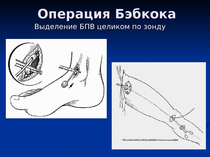 Операция троянова