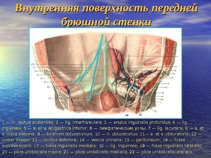 Внутренняя поверхность передней брюшной стенки 1 — m. rectus abdominis; 2 — lig. interfoveolare;