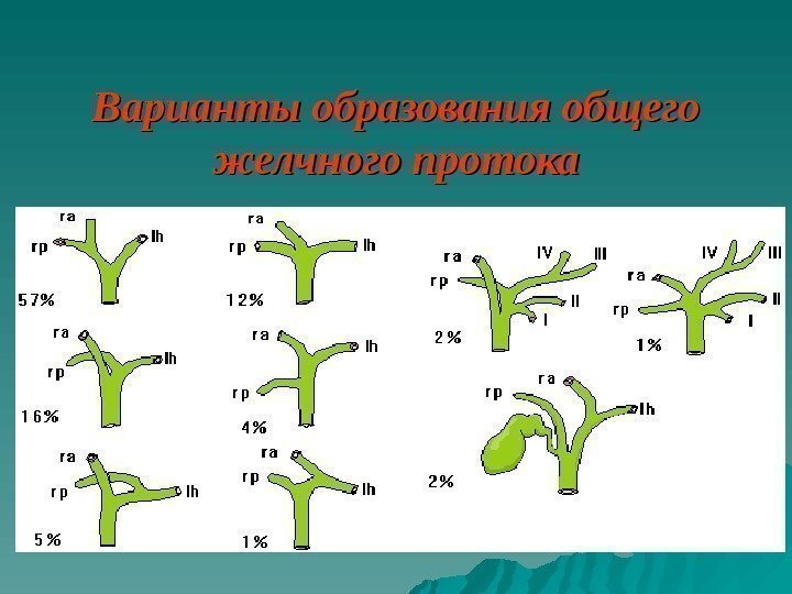   Варианты образования общего желчного протока 