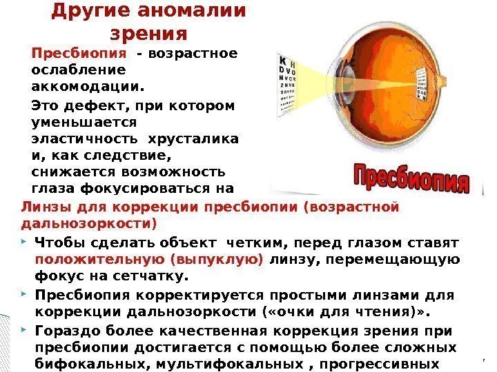 Пресбиопия  - возрастное ослабление аккомодации.  Это дефект, при котором уменьшается эластичность хрусталика