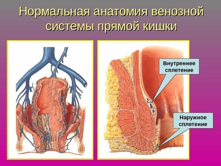   Нормальная анатомия венозной системы прямой кишки Внутреннее сплетение Наружное сплетение 