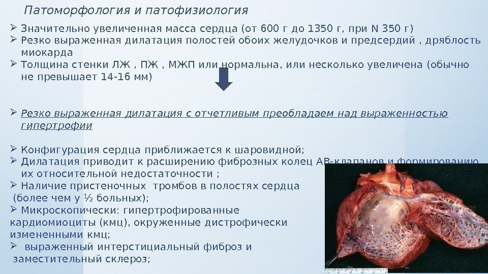 Патоморфология и патофизиология Значительно увеличенная масса сердца (от 600 г до 1350 г, при