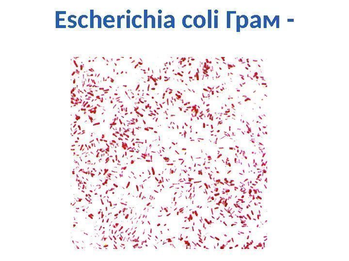 Escherichia coli Грам - 