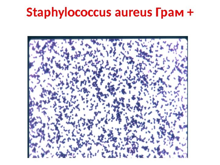 Staphylococcus aureus Грам + 