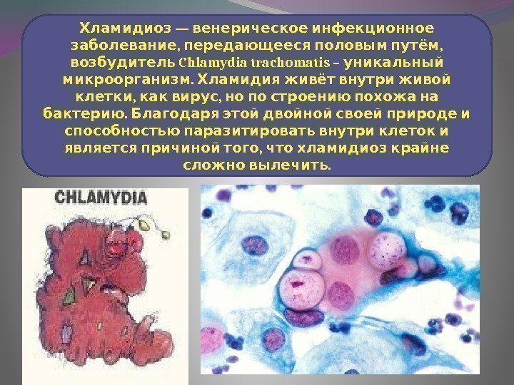  — Хламидиоз венерическое инфекционное ,  ,  заболевание передающееся половым путём Chlamydia