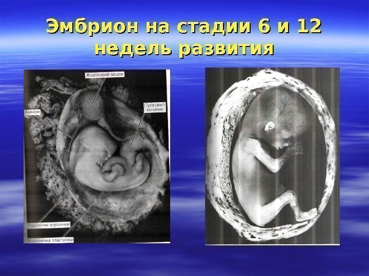 Эмбрион на стадии 6 и 12 недель развития 