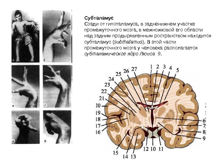  Субталамус Сзади от гипоталамуса, в задненижнем участке промежуточного мозга, в межножковой его области
