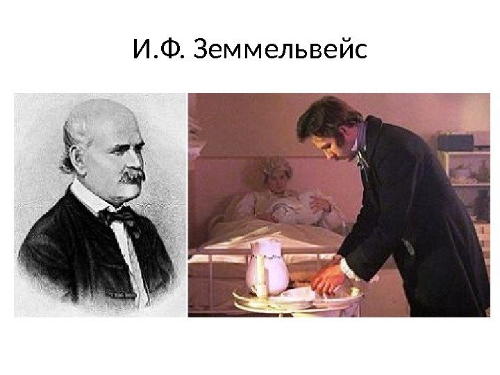 И. Ф. Земмельвейс 