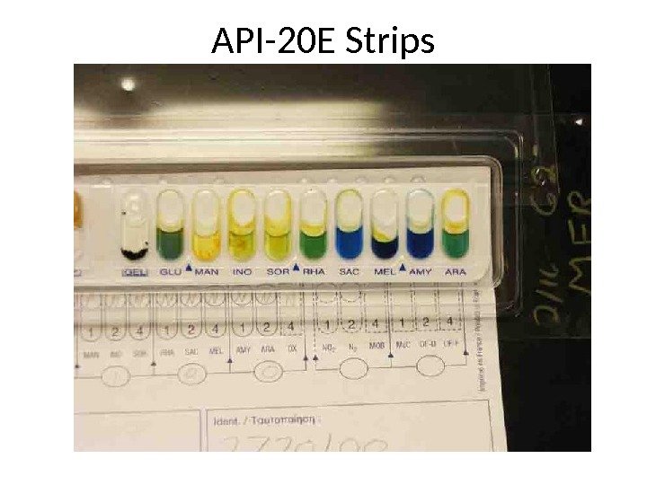 API-20 E Strips 