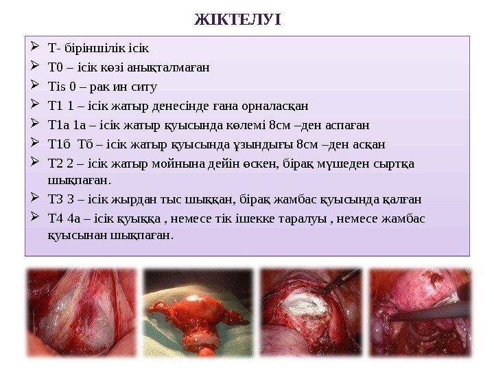 ЖІКТЕЛУІ  Т- біріншілік ісік Т 0 – ісік к зі аны талма анө