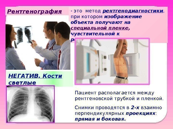 Рентгенография - это метод рентгенодиагностики ,  при котором изображение объекта получают на специальной
