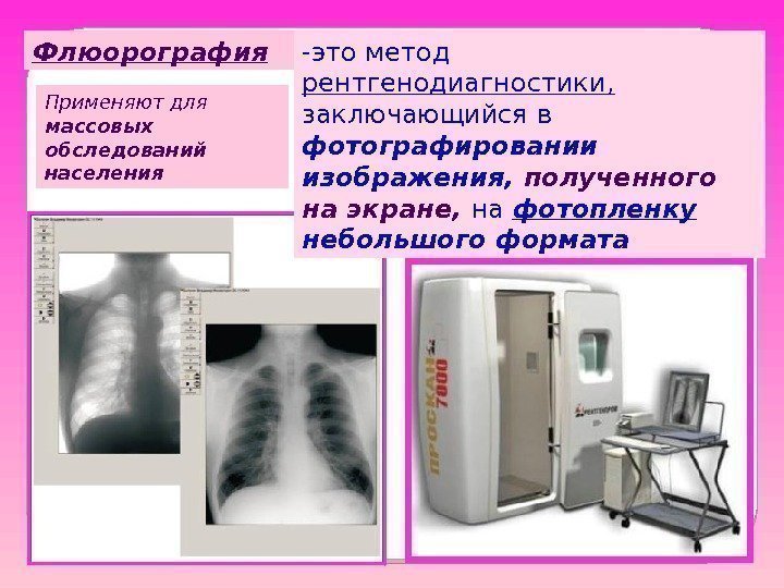 Флюорография -это метод рентгенодиагностики,  заключающийся в фотографировании изображения,  полученного на экране, 