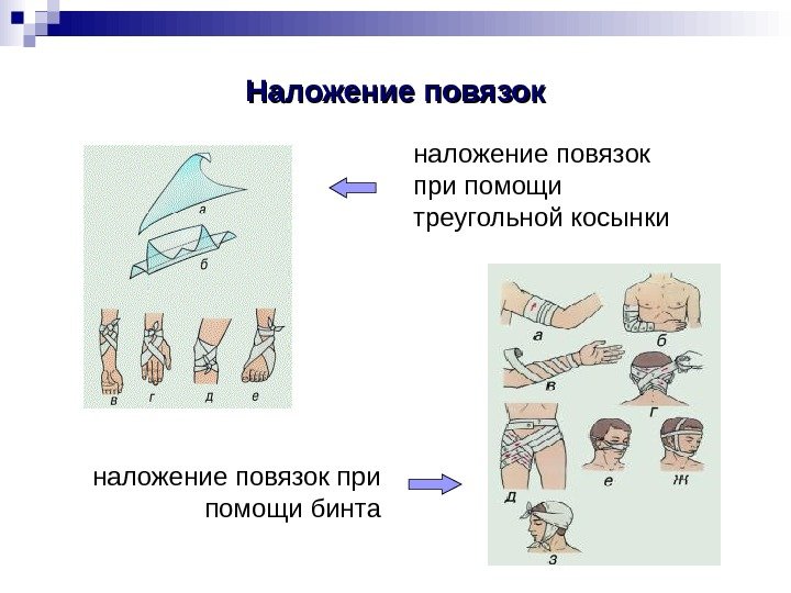   Наложение повязок наложение повязок при помощи треугольной косынки наложение повязок при помощи