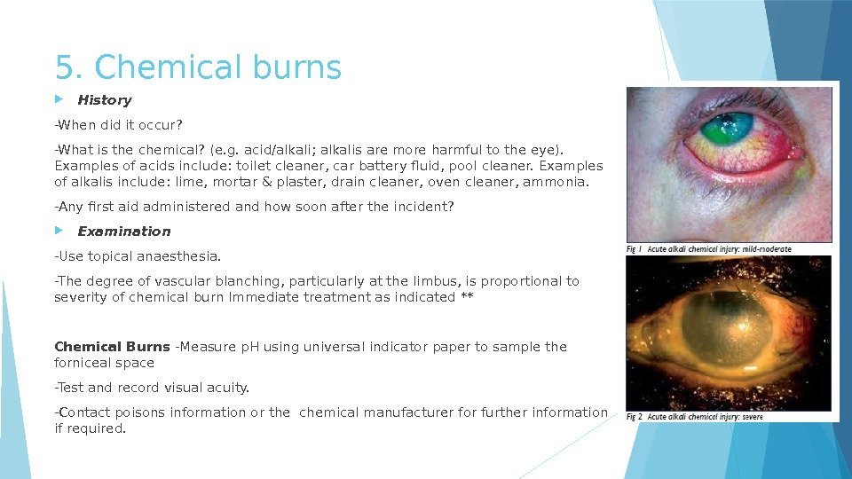 5. Chemical burns History -When did it occur? -What is the chemical? (e. g.