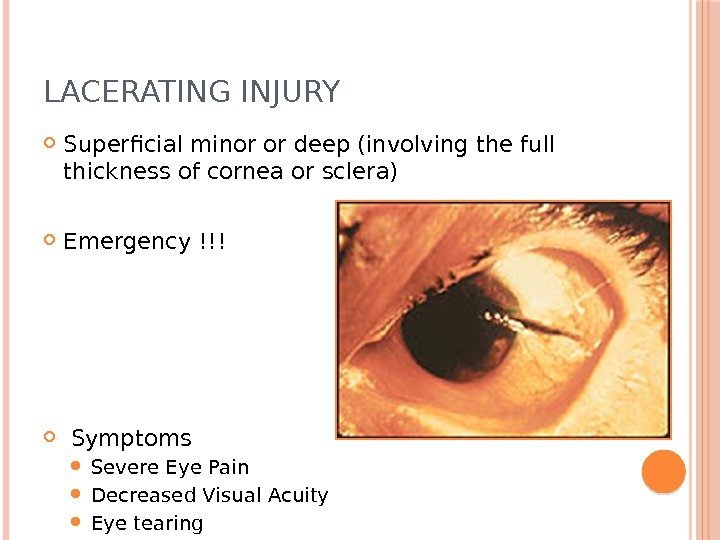 LACERATING INJURY Superficial minor or deep (involving the full thickness of cornea or sclera)