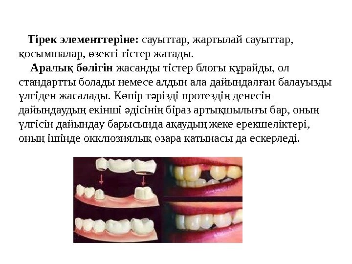   Тірек элементтеріне:  сауыттар, жартылай сауыттар,  осымшалар,  зекті тістер жатады.