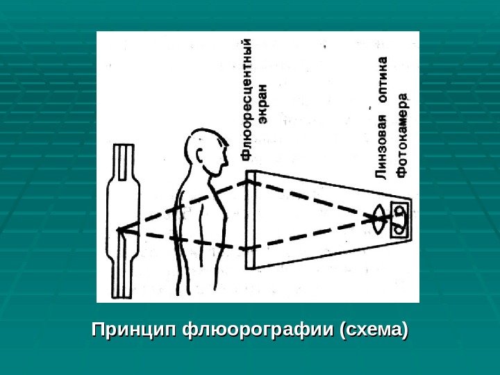 Принцип флюорографии (схема) 