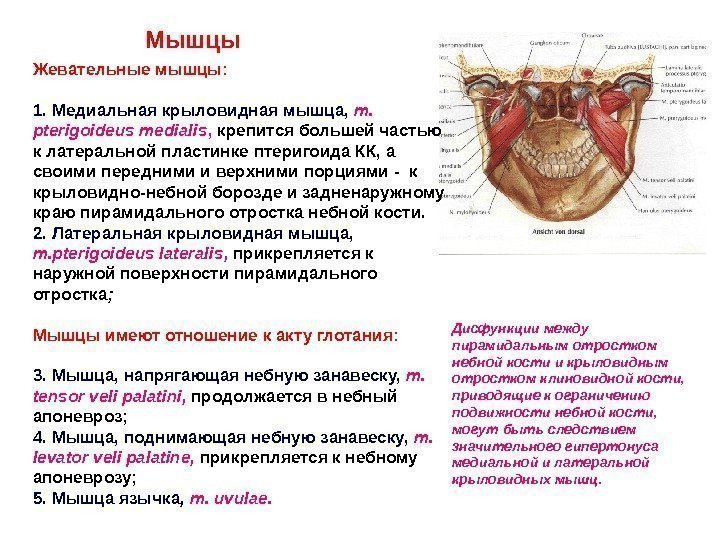 Жевательные мышцы: 1. Медиальная крыловидная мышца,  m.  pterigoideus medialis ,  крепится