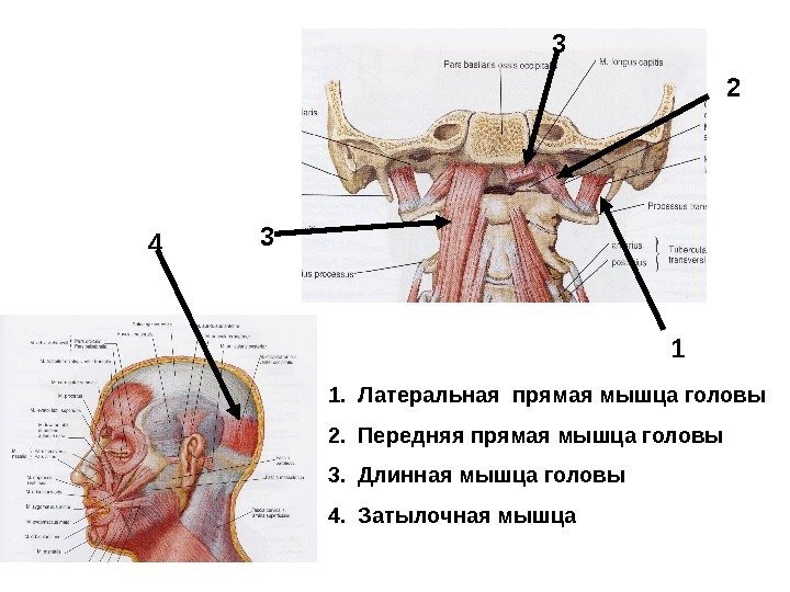 1. Латеральная прямая мышца головы 2. Передняя прямая мышца головы 3. Длинная мышца головы