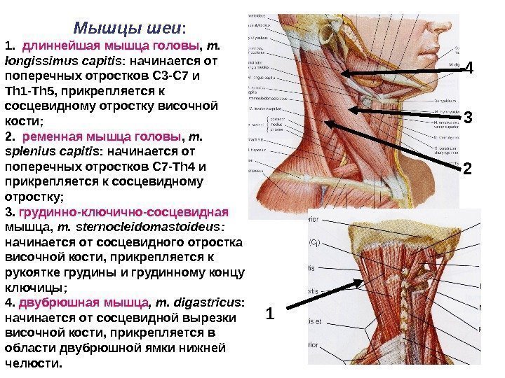 Мышцы шеи : 1.  длиннейшая мышца головы ,  m.  longissimus capitis