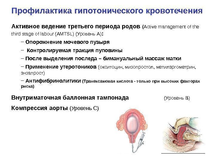 Профилактика гипотонического кровотечения Активное ведение третьего периода родов ( Active management of the third