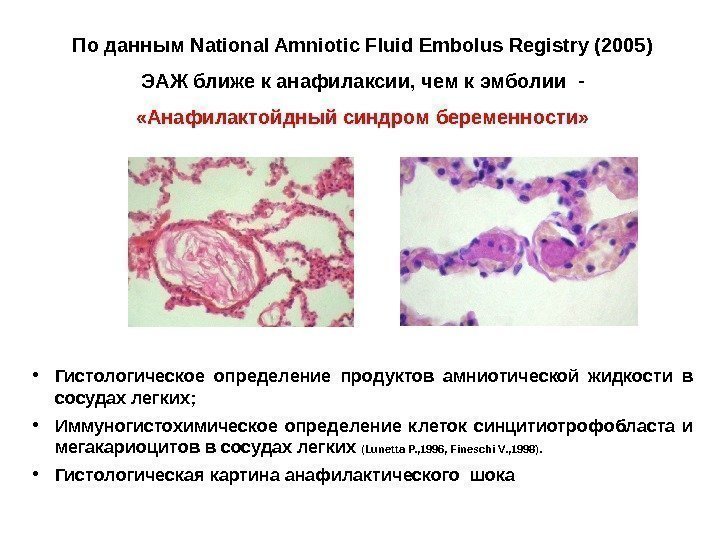 По данным National Amniotic Fluid Embolus Registry (2005) ЭАЖ ближе к анафилаксии, чем к