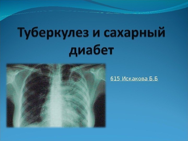 615 Искакова Б. Б 