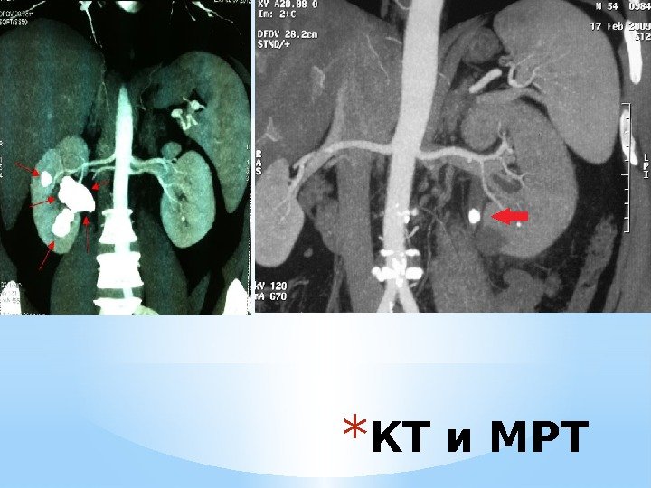 * КТ и МРТ 