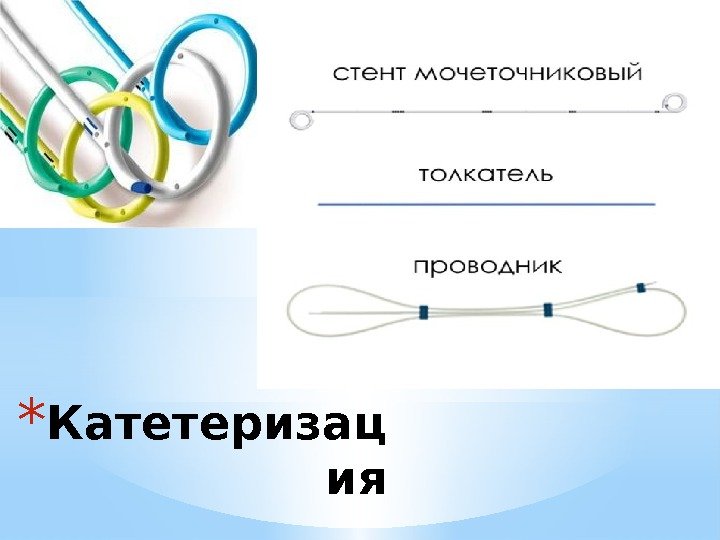 * Катетеризац ия  мочеточника 
