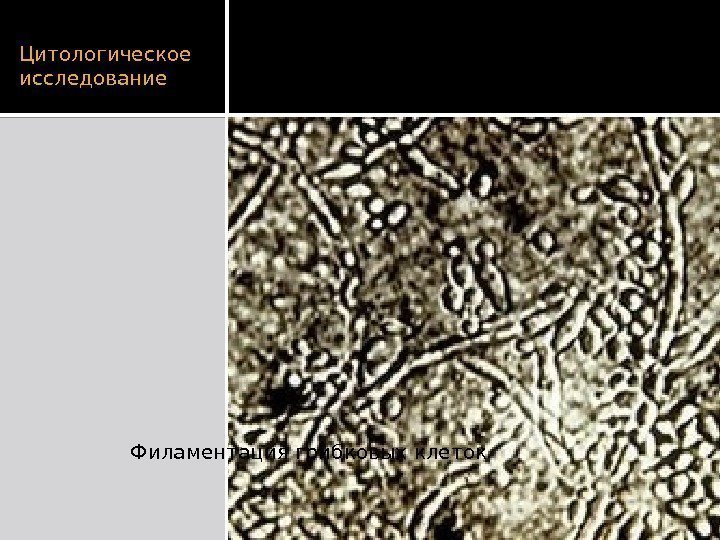 Цитологическое исследование Филаментация грибковых клеток  